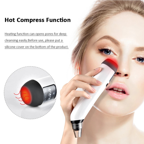 Beautters RF Blackhead Remover | Deep Pore Cleanser with Skin-Softening RF Therapy