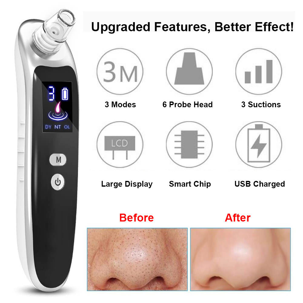 Beautter's LCD Display 3 Speeds Sucking Pore Cleanser Beauty Care Product Acne Removal Blackhead Remover Vacuum
